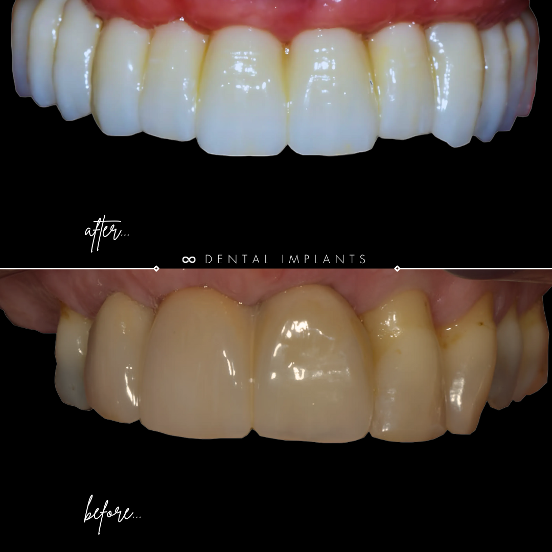 TEETH TRANSFORMATIONS - 2025-02-12T094826.705