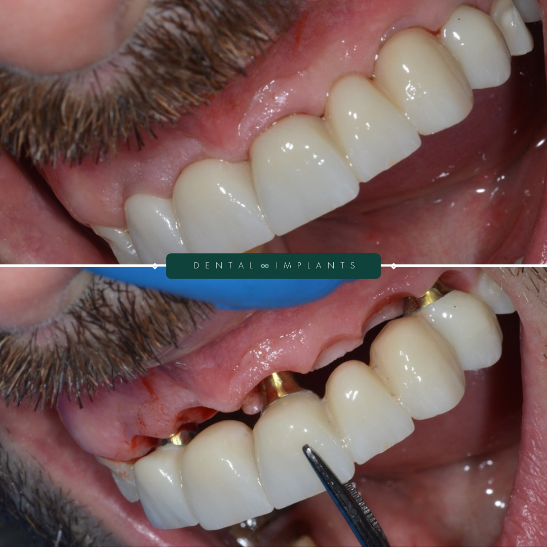 TEETH TRANSFORMATIONS - 2025-02-24T093706.610