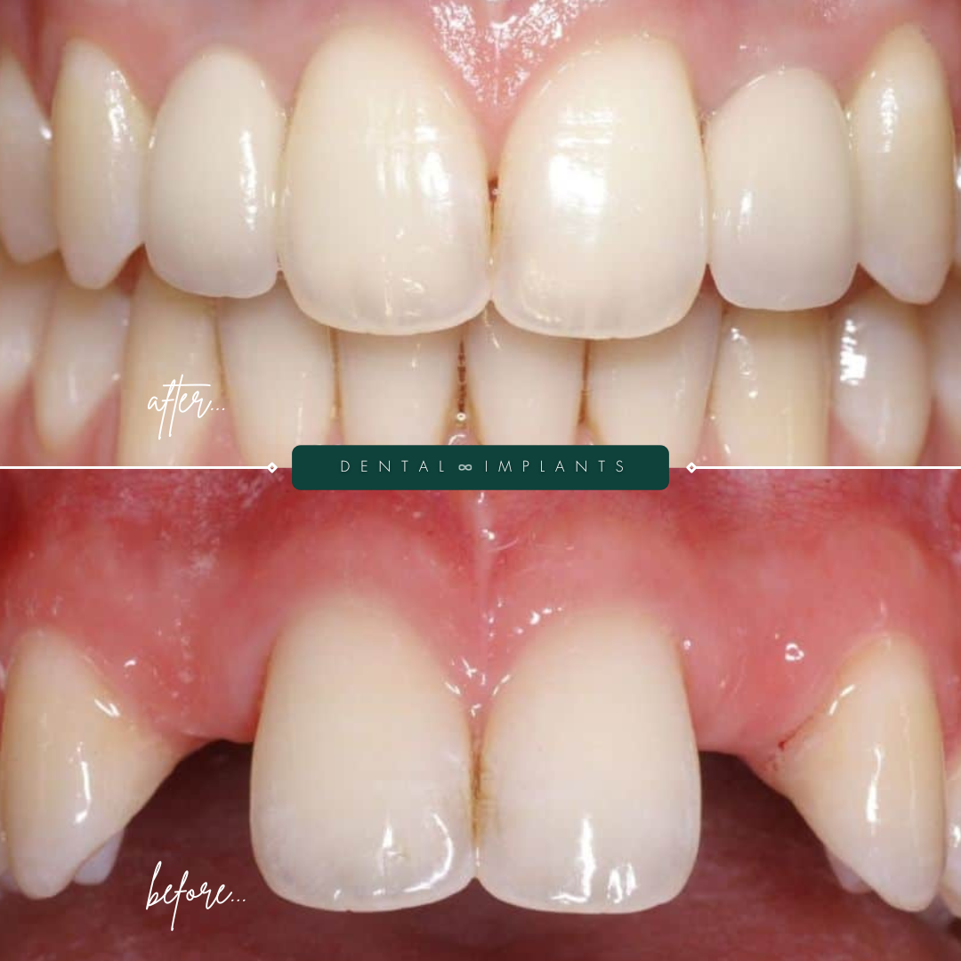 TEETH TRANSFORMATIONS - 2025-02-24T134616.763