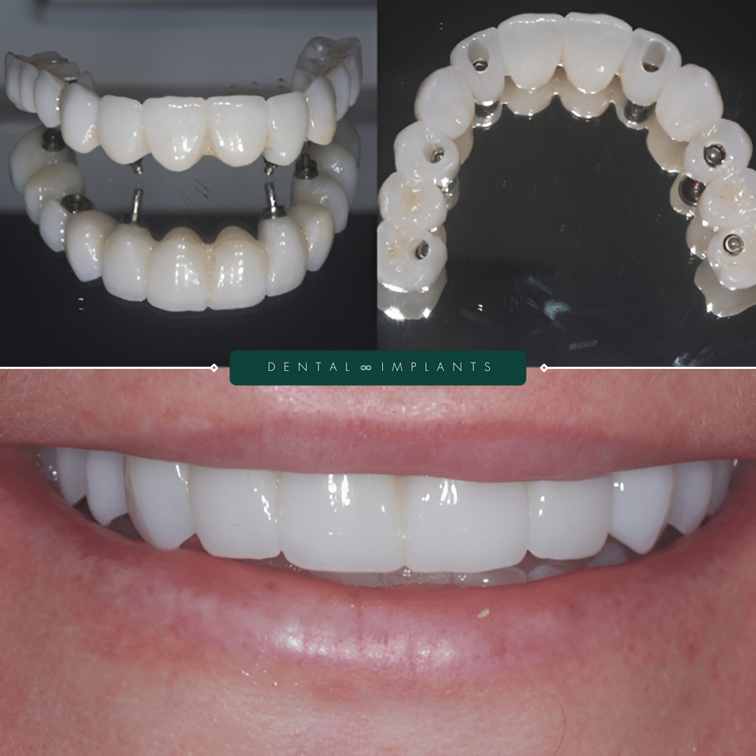 TEETH TRANSFORMATIONS - 2025-02-24T181729.286