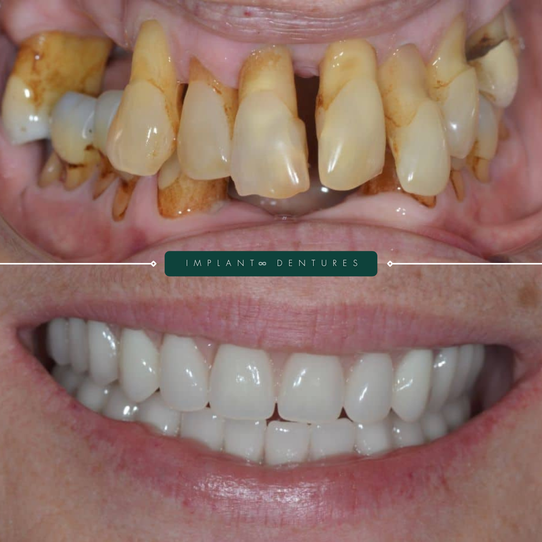 TEETH TRANSFORMATIONS - 2025-02-24T192429.425