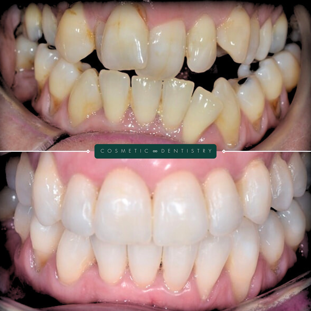 TEETH TRANSFORMATIONS - 2025-02-25T094647.092