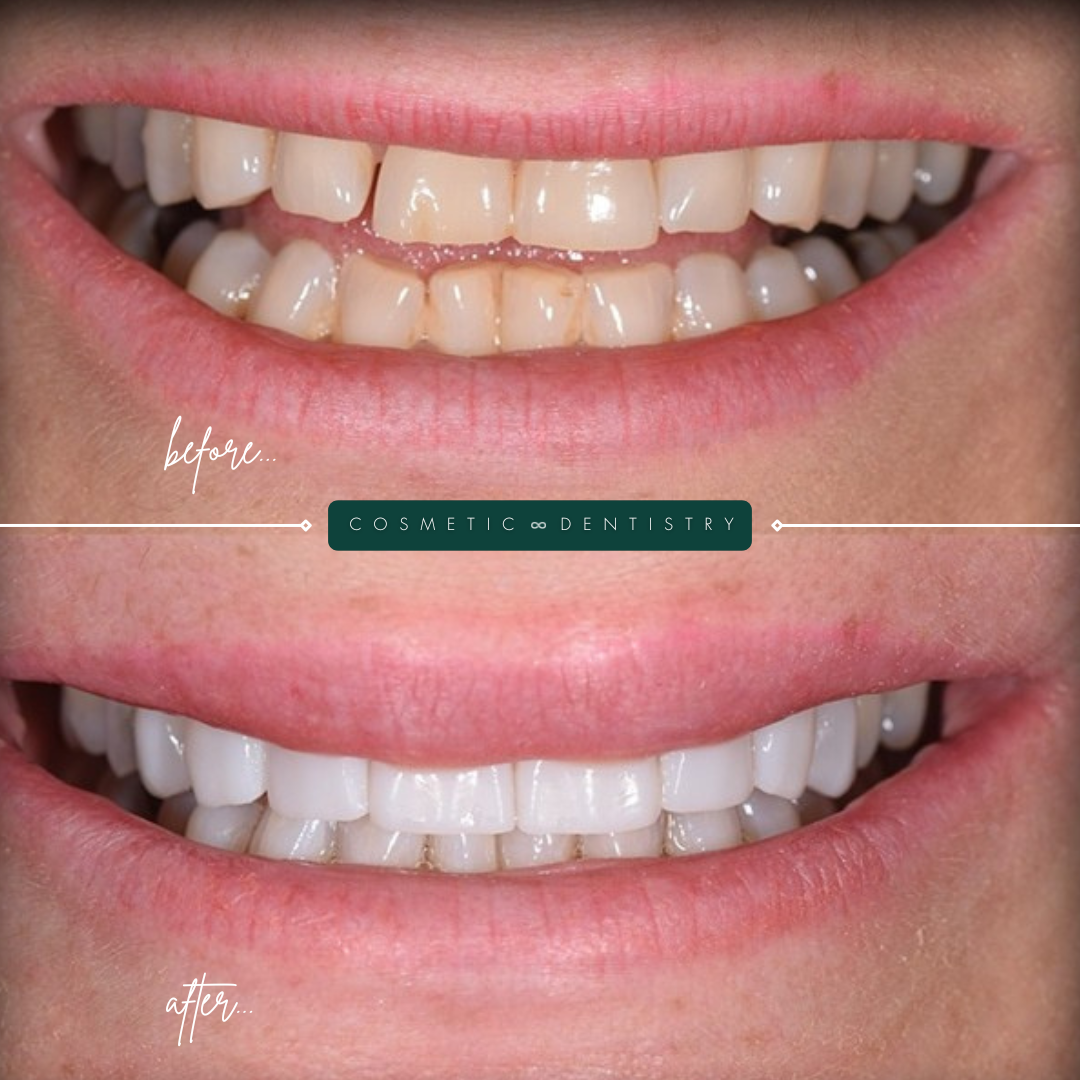 TEETH TRANSFORMATIONS - 2025-02-25T110739.360