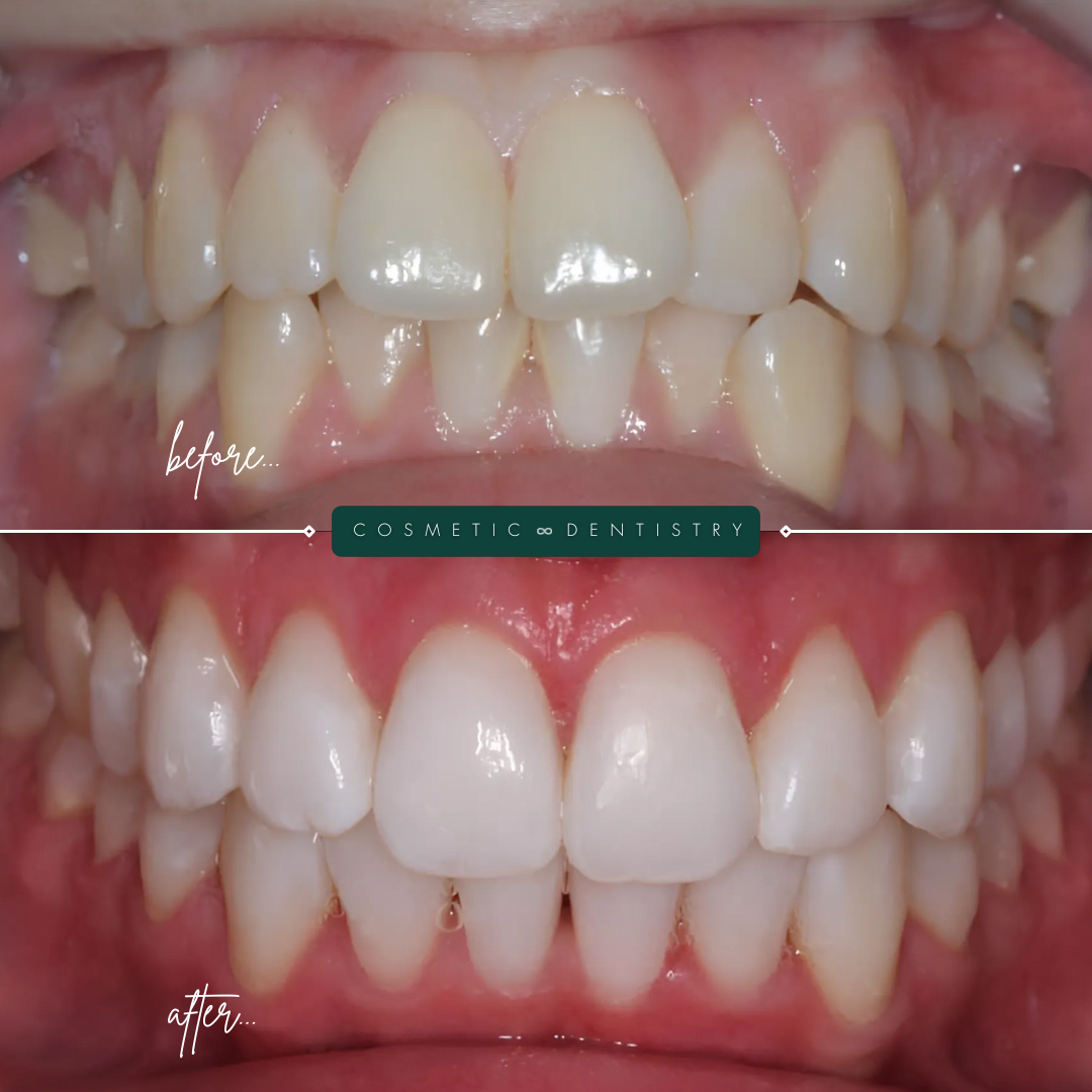 TEETH TRANSFORMATIONS - 2025-02-25T123527.771